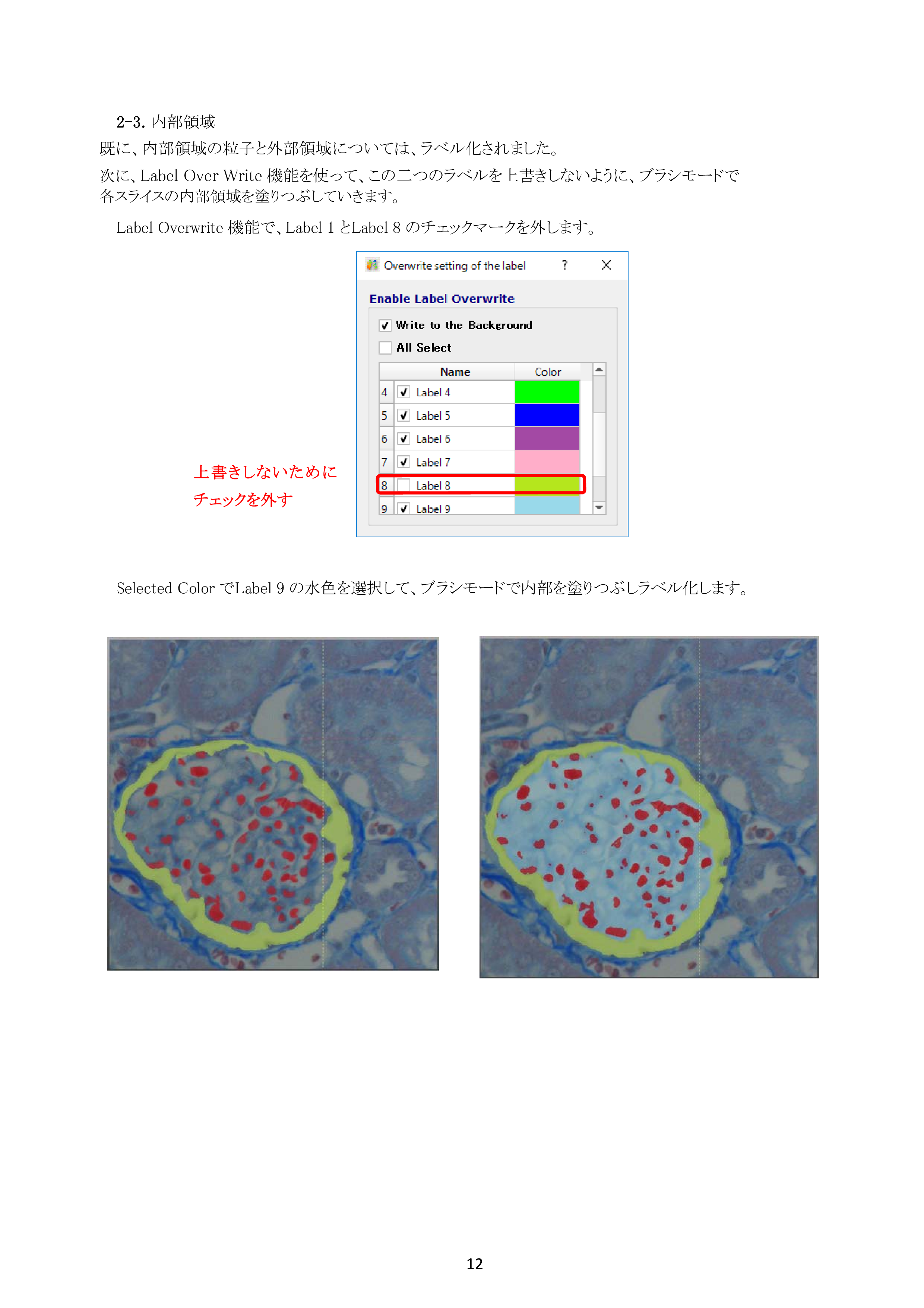 IV-Seg_Segmentation02-11.png